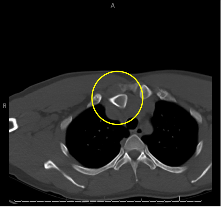 ct-chest-2.png