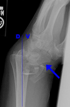 Wrist Case 5 History Physical Exam