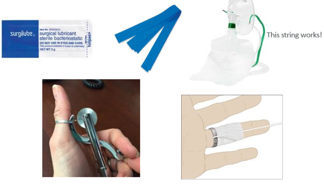 ring removal techniques