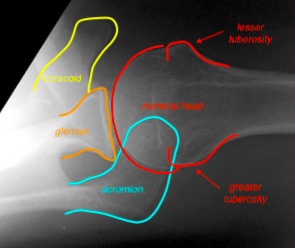 axillaryview